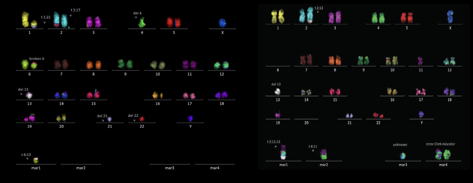Two multicolor FISH karyograms of crisis cells
