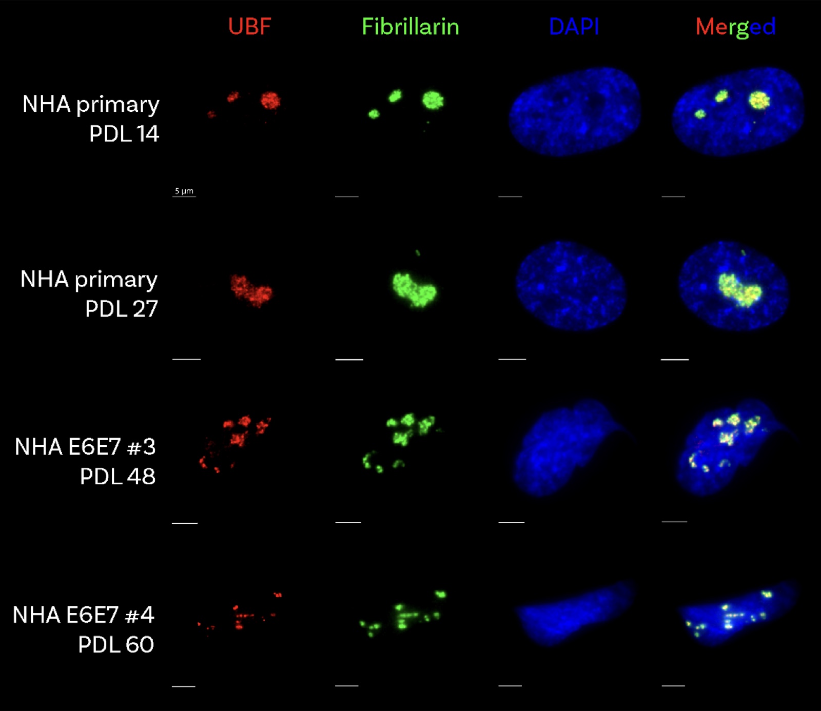UBF/fibrillarin immunofluorescence, compact vs necklace nucleoli